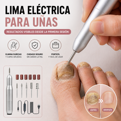 💅👍 Lima de uñas eléctrica para el tratamiento de la onicomicosis