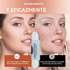 【Compra 1 y llévate 1 gratis】💓Descuento de último día💥Juego de herramientas de grado médico para eliminar puntos negros