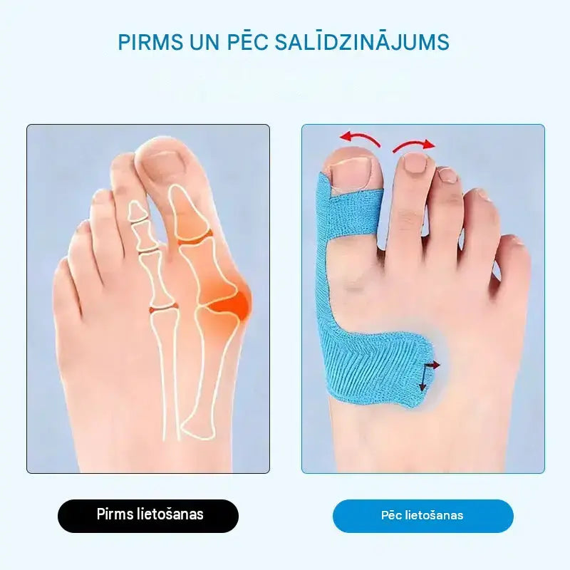 [100 gab.] Elastīgi pirkstu aizsargi, apdegumu plāksteri, izturīgi sporta pārsēji