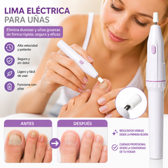 ✨💅 Lima de uñas eléctrica para eliminar cutículas gruesas y piel muerta de las uñas.