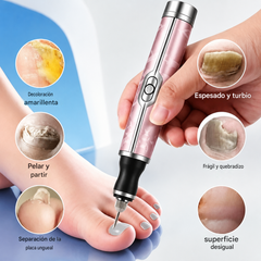 💅👍 Lima eléctrica para uñas para el tratamiento de la onicomicosis