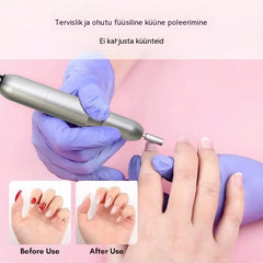 💅👍 Elektriline küüneviil onühhomükoosi raviks