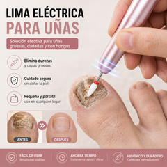 💅👍 Lima de uñas eléctrica para el tratamiento de la onicomicosis