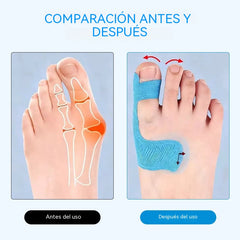 🔥【50 piezas 24€】Protectores de dedos flexibles, parches para quemaduras, vendas deportivas resistentes