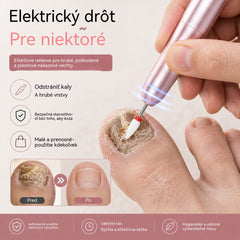 💅👍 Elektrický pilník na nechty používaný na liečbu onychomykózy (plesne nechtov)