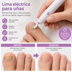 ✨💅 Lima de uñas eléctrica para eliminar cutículas gruesas y piel muerta de las uñas.
