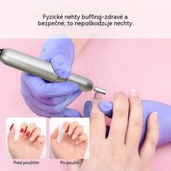 💅👍 Elektrický pilník na nechty používaný na liečbu onychomykózy (plesne nechtov)