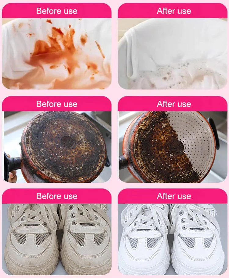 🎁【Recientemente desarrollado por médicos japoneses】Quitamanchas universal